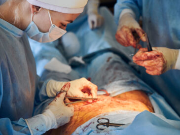 rejet fil résorbable